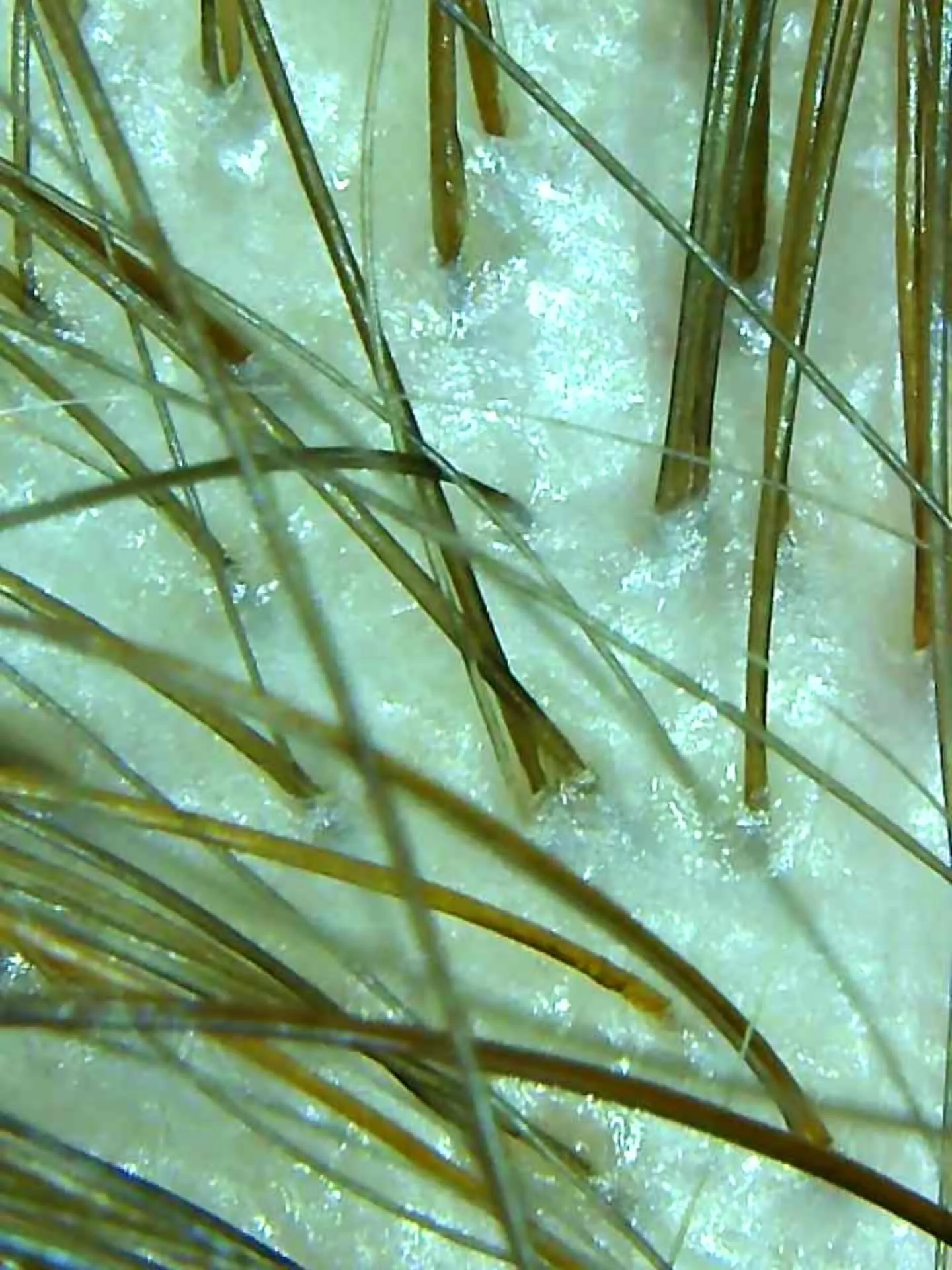 大津市で人幹細胞上清液エクソソーム×植物幹細胞＝ハツイク髪育...