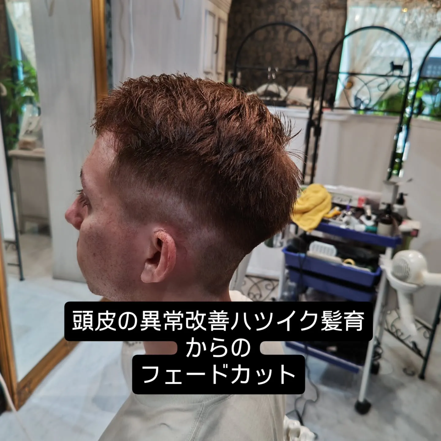 大津市で頭皮ケア発毛促進といえば？？