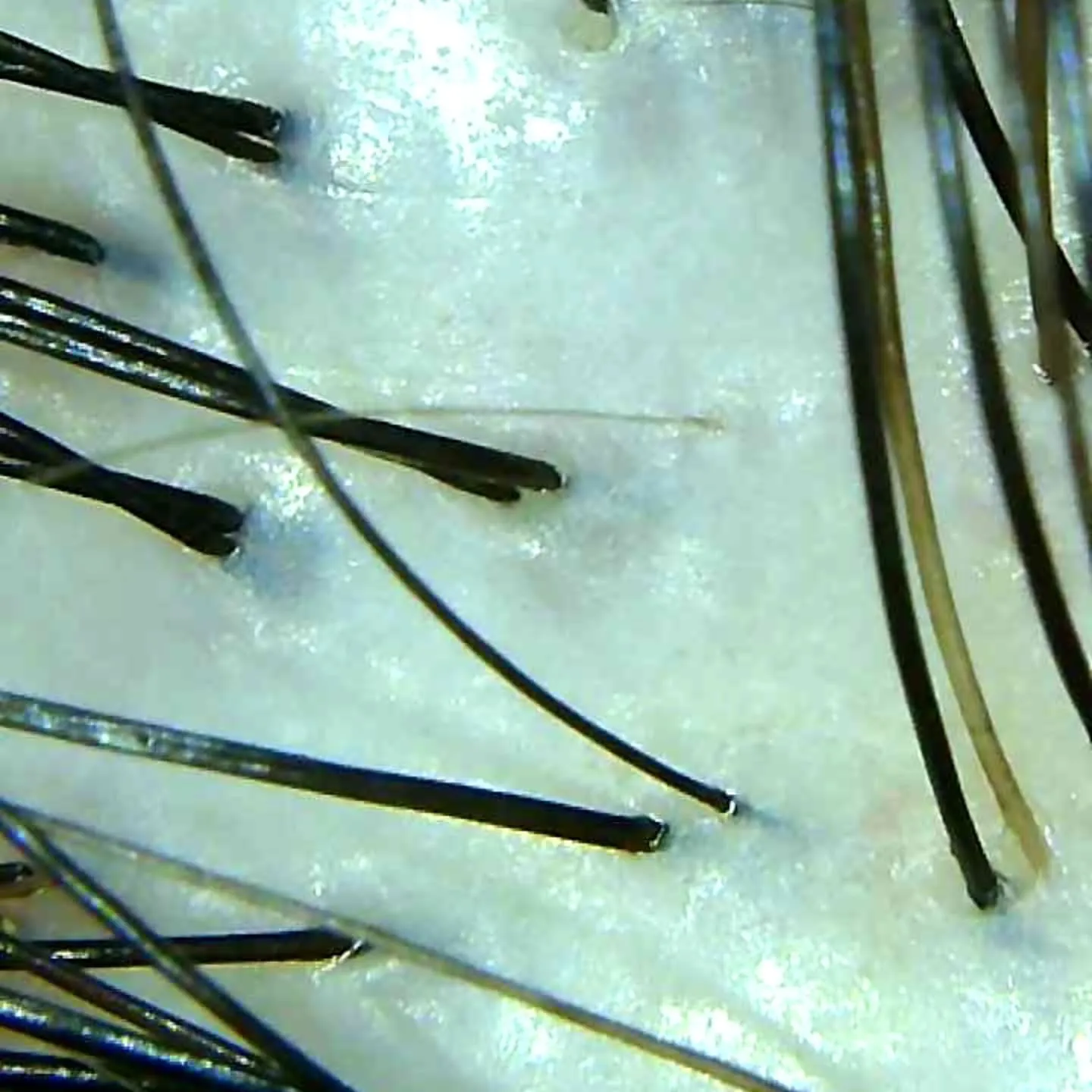 大津市で頭皮ケア発毛促進といえば？？